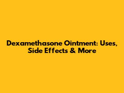 Dexamethasone Ointment: Uses, Side Effects & More