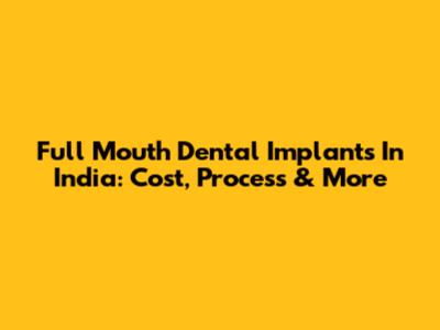 Full Mouth Dental Implants In India: Cost, Process & More