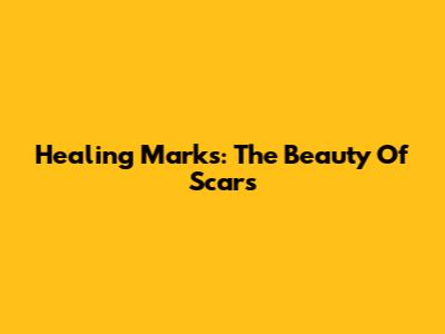 Healing Marks: The Beauty Of Scars