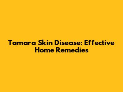 Tamara Skin Disease: Effective Home Remedies